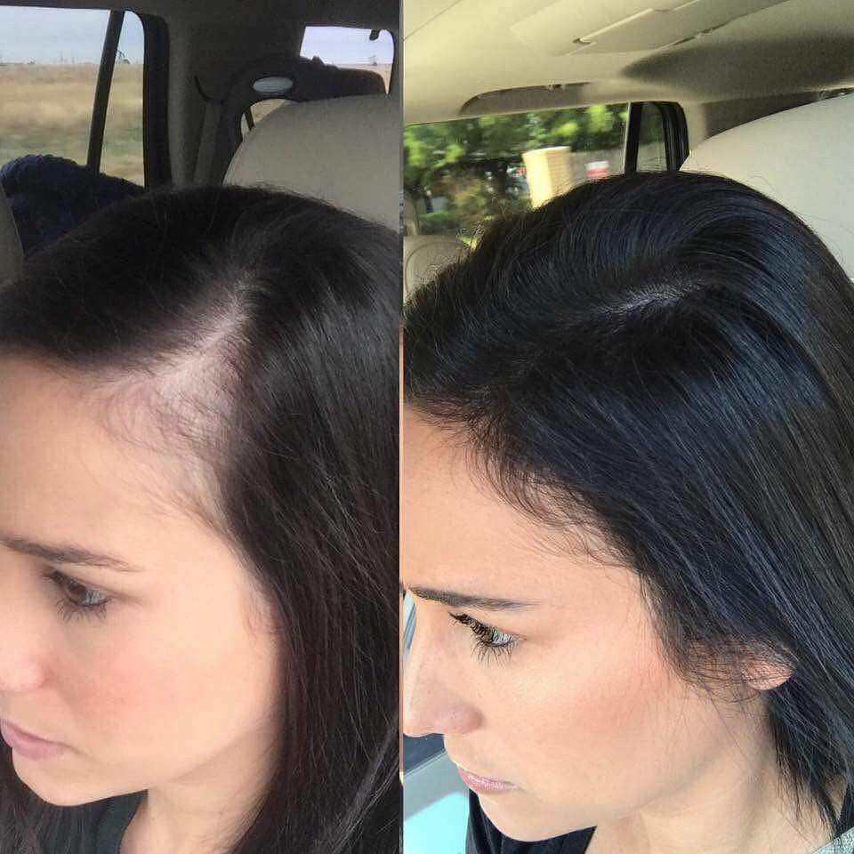 Scalp Stimulator Hair Growth Oil