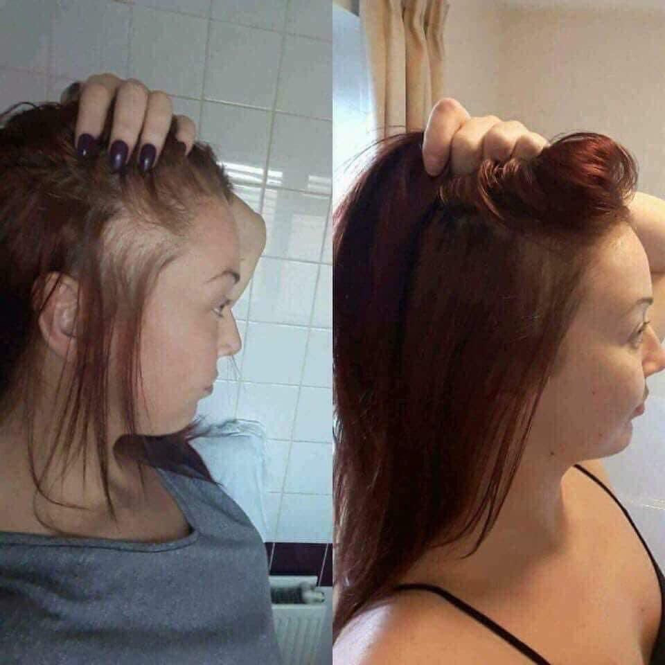 Scalp Stimulator Hair Growth Oil